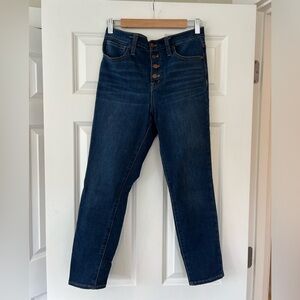 Button Front Madewell Skinny Jeans